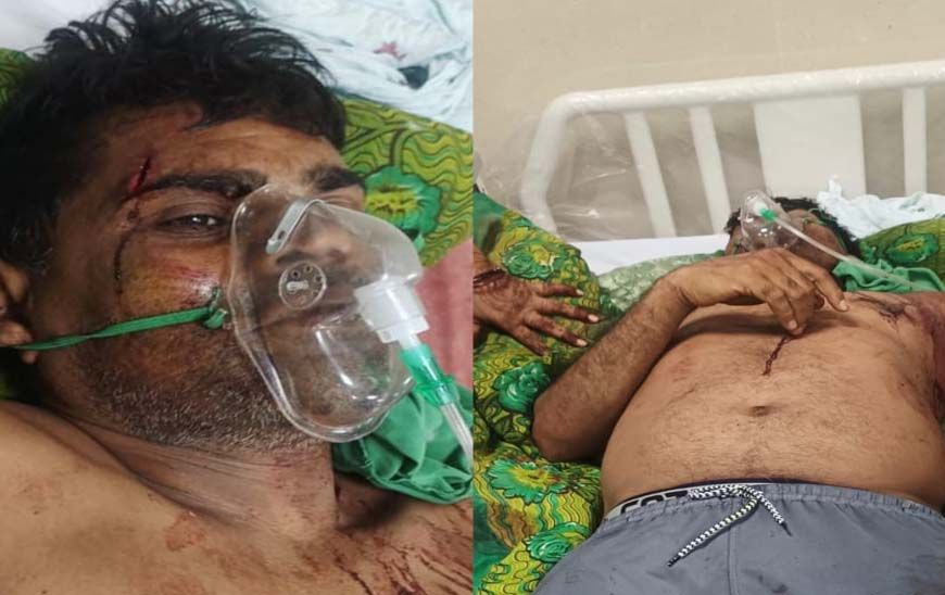 कुल्हाड़ी से हमला: गाली-गलौज का विरोध करने पर पूर्व जनपद सदस्य प्रतिनिधि पर जानलेवा वार