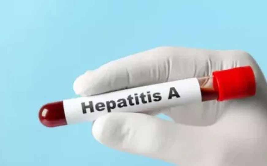 यूपी में हेपेटाइटिस ए का बड़ा खतरा, 97% सैंपल पॉजिटिव मिले