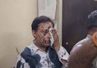 अजमेर स्याही कांड: पुलिस कस्टडी में कांग्रेस नेता पर हमला, 3 पुलिसकर्मी लाइन हाजिर
