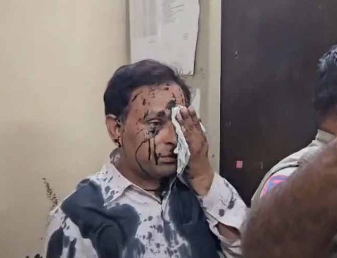 अजमेर स्याही कांड: पुलिस कस्टडी में कांग्रेस नेता पर हमला, 3 पुलिसकर्मी लाइन हाजिर