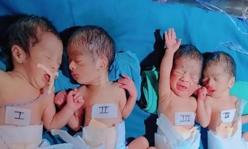 खरगोन में हैरान करने वाली घटना: एक महिला ने जन्म दिए चार बच्चे, दो बेटे और दो बेटियां