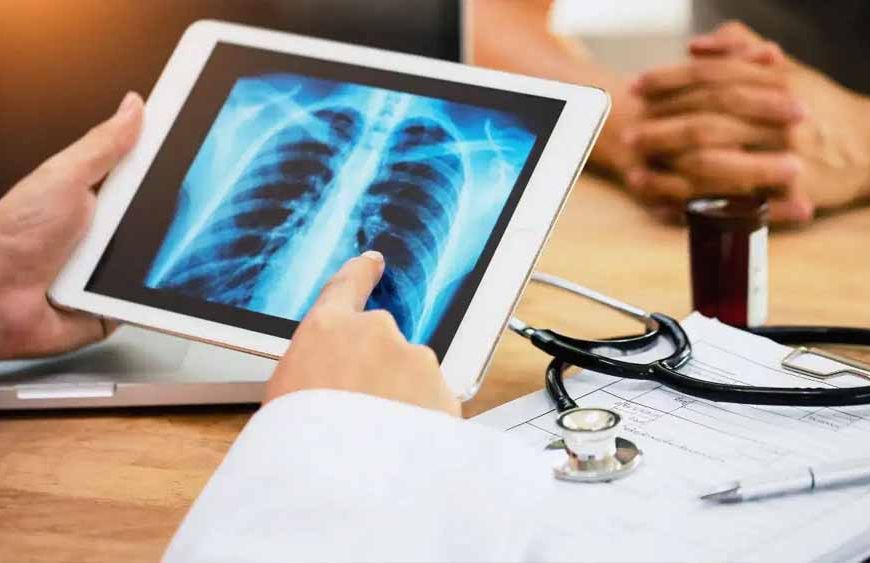 बिहार में TB मरीजों की तुरंत पहचान: 56 प्रशिक्षित एक्स-रे तकनीशियन किए गए तैनात