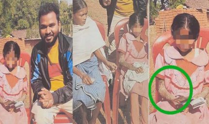 पत्थर शरीर वाली बच्ची के उपचार को लेकर बाल आयोग सक्रिय