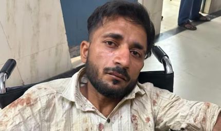 UP पुलिस परीक्षा देने जा रही छात्राओं से छेड़छाड़, आरोपी ऑटो ड्राइवर पुलिस एनकाउंटर में घायल