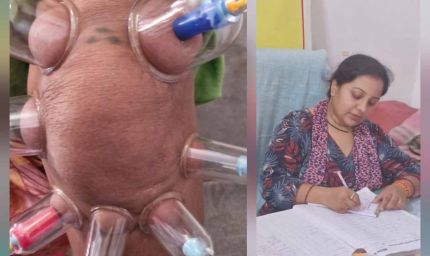 लोहरसी आयुर्वेदिक औषधालय में दर्द प्रबंधन हेतु कपिंग थेरेपी एवं विशेष आयुर्वेदिक उपचार सेवाओं का आरंभ