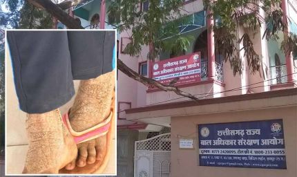 बाल आयोग अध्यक्ष की पहल रंग लाई, गंभीर बीमार बालिका का इलाज शुरू