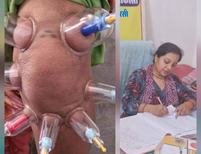 लोहरसी आयुर्वेदिक औषधालय में दर्द प्रबंधन हेतु कपिंग थेरेपी एवं विशेष आयुर्वेदिक उपचार सेवाओं का आरंभ