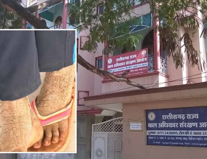 बाल आयोग अध्यक्ष की पहल रंग लाई, गंभीर बीमार बालिका का इलाज शुरू