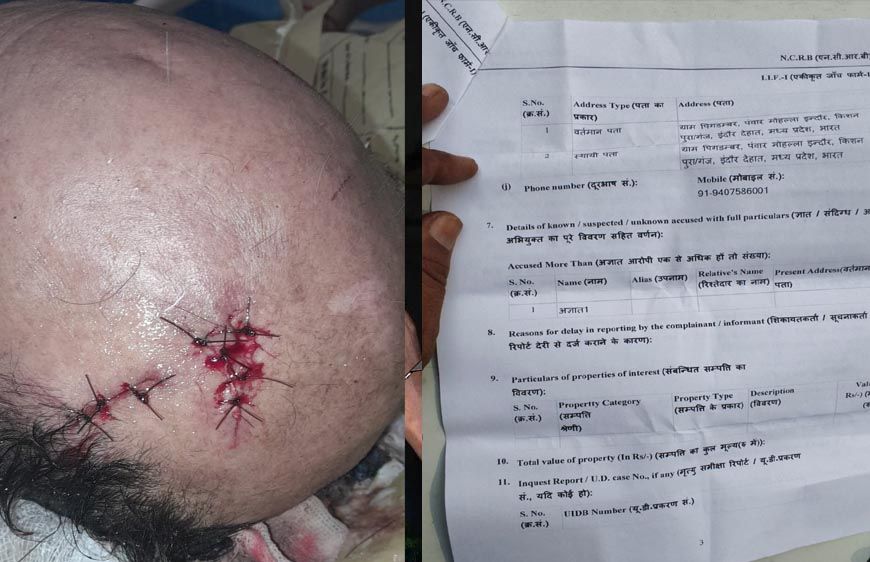 अधिमान्य पत्रकार नेतृत्व समिति के प्रदेश कार्यवाहक अध्यक्ष पर प्राण घातक हमला