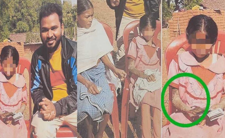 पत्थर शरीर वाली बच्ची के उपचार को लेकर बाल आयोग सक्रिय