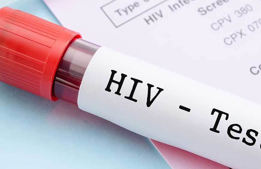 मध्यप्रदेश में HIV के बढ़ते मामले चिंता का कारण, केस दोगुने; जांच और जागरूकता पर सवाल
