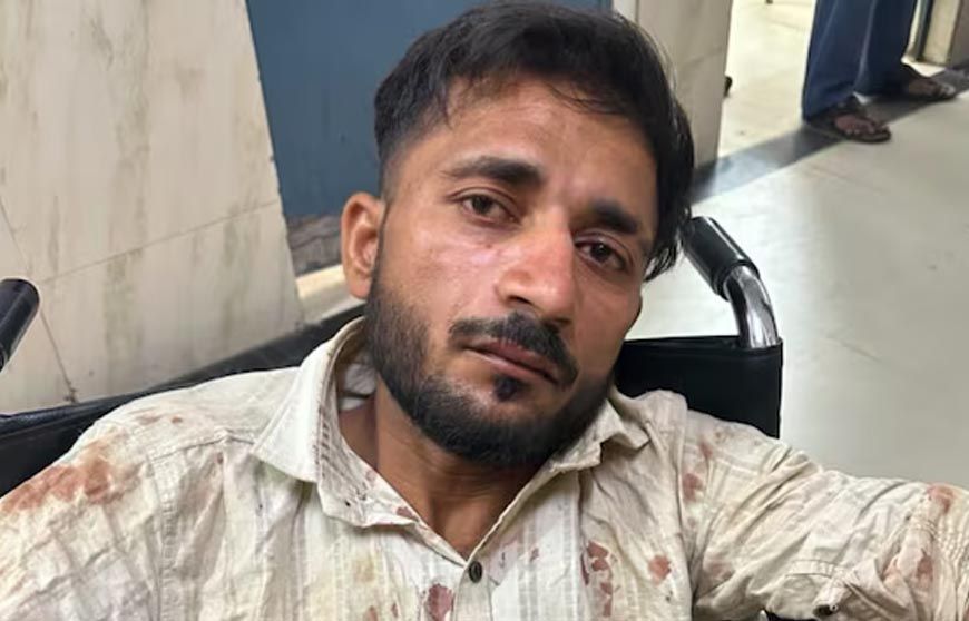 UP पुलिस परीक्षा देने जा रही छात्राओं से छेड़छाड़, आरोपी ऑटो ड्राइवर पुलिस एनकाउंटर में घायल