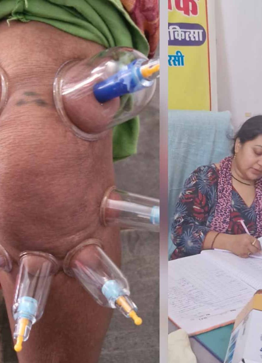 लोहरसी आयुर्वेदिक औषधालय में दर्द प्रबंधन हेतु कपिंग थेरेपी एवं विशेष आयुर्वेदिक उपचार सेवाओं का आरंभ