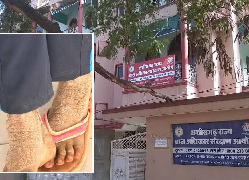 बाल आयोग अध्यक्ष की पहल रंग लाई, गंभीर बीमार बालिका का इलाज शुरू