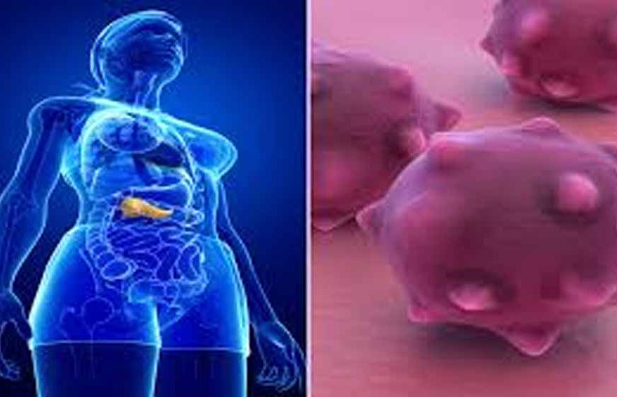 सिर्फ 60 रुपए में होगी पैंक्रियाज कैंसर की जांच, IIT दिल्ली ने विकसित की सस्ती तकनीक