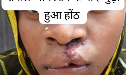 सफल सर्जरी से भीमे हेमला के चेहरे पर लौटी मुस्कान