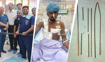 शरीर में आर-पार घुसे 4 लोहे के सरिये, KGMU के डॉक्टरों ने साढ़े आठ घंटे की सर्जरी से बचाई मजदूर की जान
