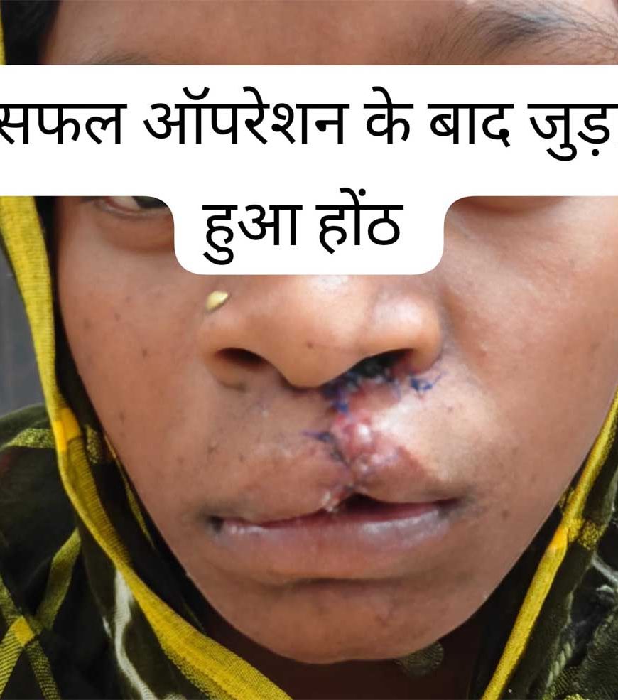 सफल सर्जरी से भीमे हेमला के चेहरे पर लौटी मुस्कान