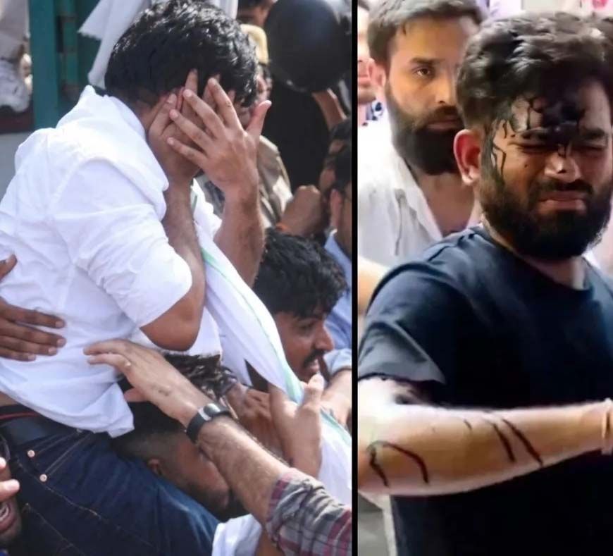 दिल्ली में अभिजीत दीपके पर स्याही फेंकी, जयपुर थप्पड़ कांड की याद ताजा