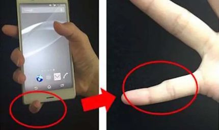 स्मार्टफोन पिंकी क्या है? ज्यादा फोन इस्तेमाल से उंगली पर पड़ सकता असर