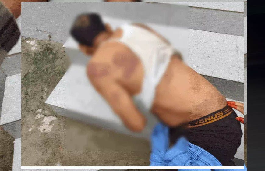 भिंड में सहायक सचिव का अपहरण, 13 घंटे बंधक बनाकर बेरहमी से पीटा; पिस्टल की नोक पर चेक और स्टांप पेपर पर कराए साइन