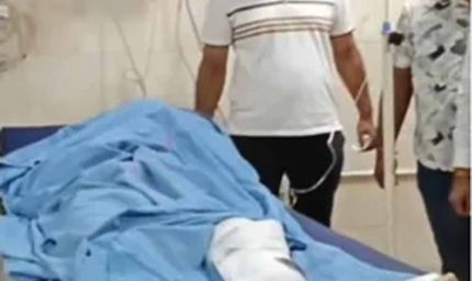 कुरुक्षेत्र में 2 लाख की लूट के आरोपी का एनकाउंटर, पुलिस ने पैर में मारी गोली