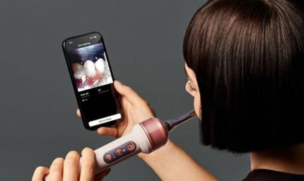 Dyson ने लॉन्च किया AI वाला CameraJet टूथब्रश, कैमरा देखकर खुद साफ करेगा दांतों के गैप