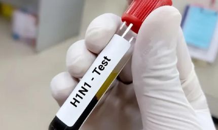 हिसार में स्वाइन फ्लू का कहर, एक और महिला की मौत; जिले में 3 ने गंवाई जान