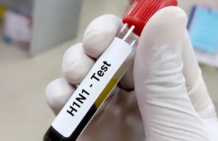 हिसार में स्वाइन फ्लू का कहर, एक और महिला की मौत; जिले में 3 ने गंवाई जान