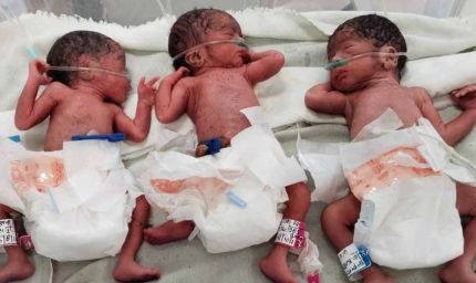 शहडोल में 10 मिनट के भीतर गूंजीं तीन किलकारियां, 20 साल की महिला ने दिया 3 बच्चों को जन्म