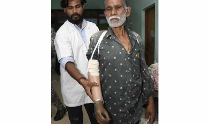 ट्रेन हादसे के दर्द पर 'सेवा संकल्प' का मरहम, धमतरी के तेजराम को दो घंटे में मिला कृत्रिम हाथ, लौटी जिंदगी की रंगत