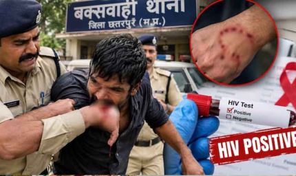 छतरपुर में रेप के आरोपी ने कांस्टेबल को काटा, मेडिकल जांच में HIV पॉजिटिव