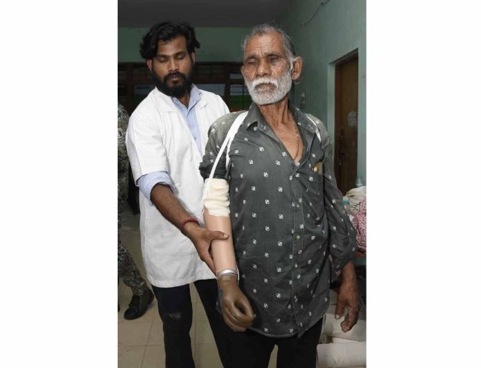ट्रेन हादसे के दर्द पर 'सेवा संकल्प' का मरहम, धमतरी के तेजराम को दो घंटे में मिला कृत्रिम हाथ, लौटी जिंदगी की रंगत