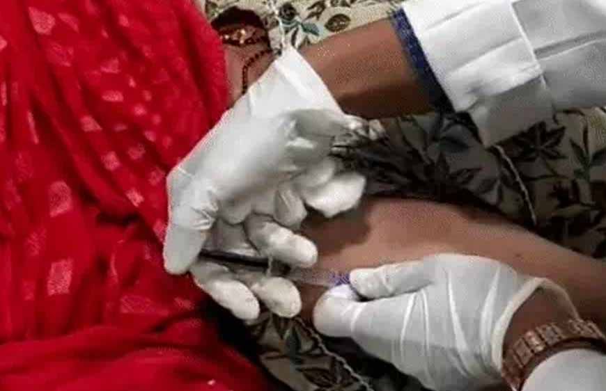 इंदौर MY अस्पताल में लाखों का बोटोक्स इलाज मुफ्त, लकवे के बाद जकड़े हाथ-पैरों में लौट रही हरकत