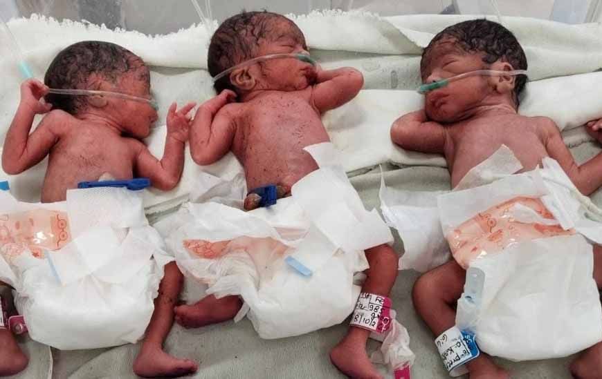 शहडोल में 10 मिनट के भीतर गूंजीं तीन किलकारियां, 20 साल की महिला ने दिया 3 बच्चों को जन्म