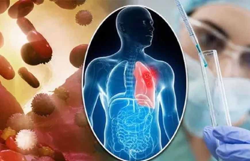 कैंसर मरीजों के लिए राहत की खबर, अब ट्यूमर पर रियल टाइम नजर रखकर दिया जा सकेगा सटीक रेडिएशन